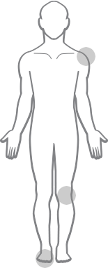 Body